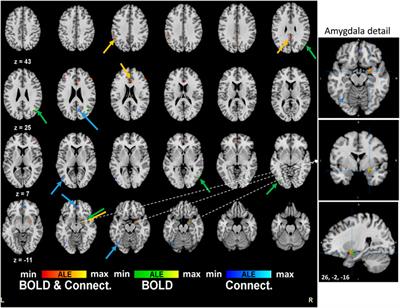 The Effects of Tryptamine Psychedelics in the Brain: A meta-Analysis of Functional and Review of Molecular Imaging Studies